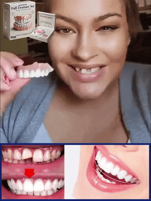 🦷Ensemble de prothèses dentaires complètes 