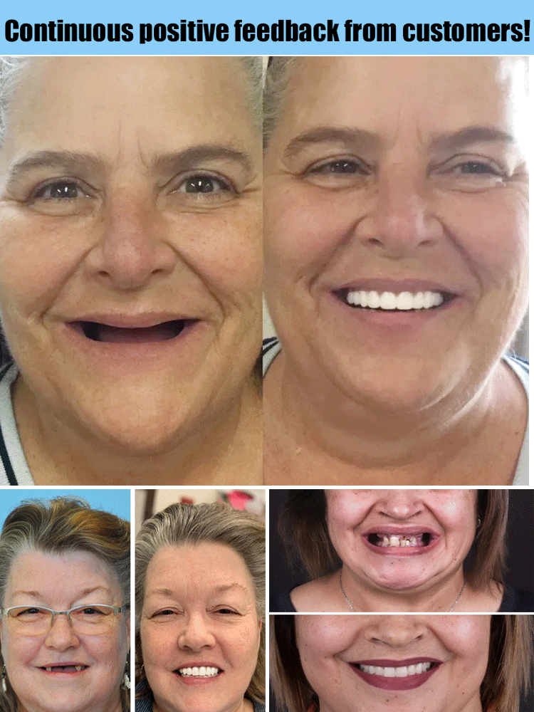 🦷Ensemble de prothèses dentaires complètes 